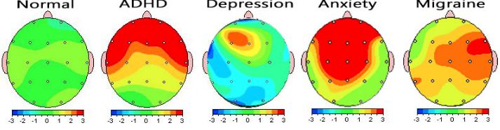 qEEG types